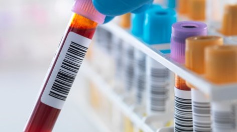 sistema-para-laboratorio-de-analises-clinicas-profissional-exames